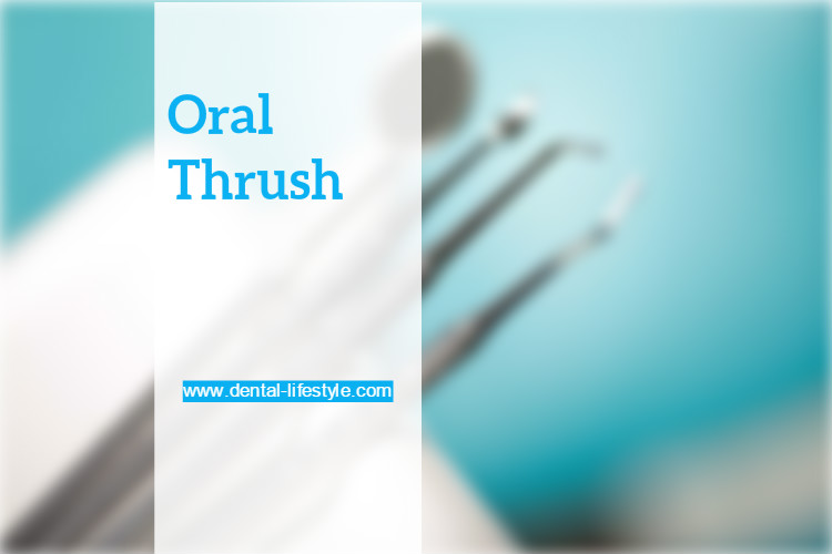 Thrush is an infection of the mouth caused by the candida fungus, also known as yeast. Candida infection is not limited to the mouth;