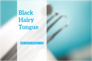 The name black hairy tongue may sound scary, but the condition is harmless. Black hairy tongue is caused by bacteria or fungi in the mouth, which make the tongue appear black and hairy.