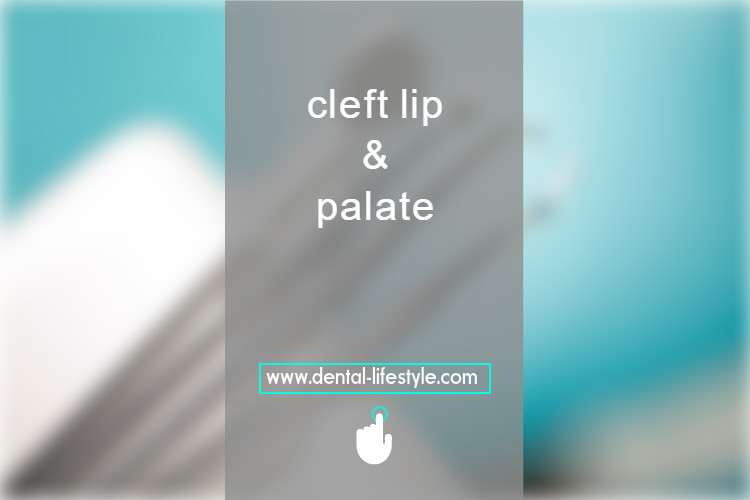 Cleft lip and cleft palate are facial and oral malformations that occur very early in pregnancy. While the baby is developing inside the mother.