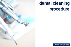 what exactly is a dental cleaning? What does your dentist do in your mouth? Aren't you curious to find out? If so, take a read!