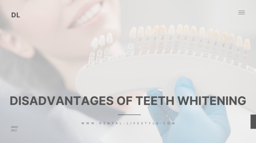 Disadvantages of Teeth Whitening