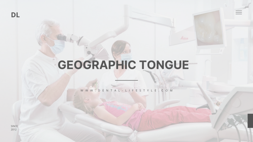 Geographic tongue is the name of a nasty condition that gets its name from its map-like appearance on the upper surface and sides of the tongue.