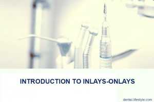 Dental inlays and onlays are restorations used to repair teeth that have a mild to moderate amount of decay. They can also be used to restore teeth that are cracked or fractured