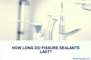 Many of you are in need of fissure sealants according to your dentist. Others are interested in learning all about them because their children are in need.