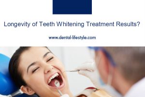 It is a very common question for us dentists, how long do the whitening treatment results last? Well, it is actually on your hands!
