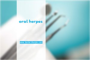 The oral herpes usually appears on the lips,herpes virus type-1 causes visible wounds and there is also the type 2 virus.