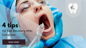 Here are a few tips to help minimize your discomfort and speed recovery time after a tooth extraction. Take a read and stay tuned for more!