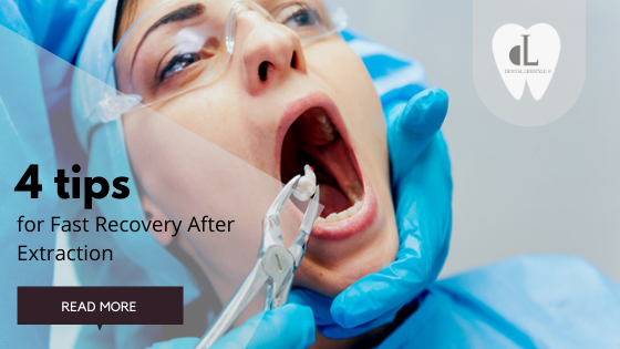 Here are a few tips to help minimize your discomfort and speed recovery time after a tooth extraction. Take a read and stay tuned for more!