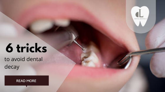 There are ways to avoid these unpleasant dental appointments and the sound of the scary drill inside your mouth. Here are six simple tips to prevent the development of decay in your teeth!