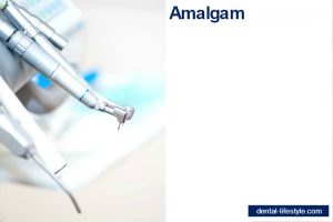 In dentistry, amalgam is an alloy of mercury with various metals used for dental fillings. It commonly consists of mercury, silver, tin, copper, and other trace metals.In the 1800s, amalgam became the dental restorative material of choice due to its low cost, ease of application, strength, and durability.