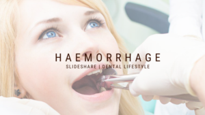 Hemorrhage in the dental clinic happens often, usually, it isn't severe. There are times it could get out of hand.