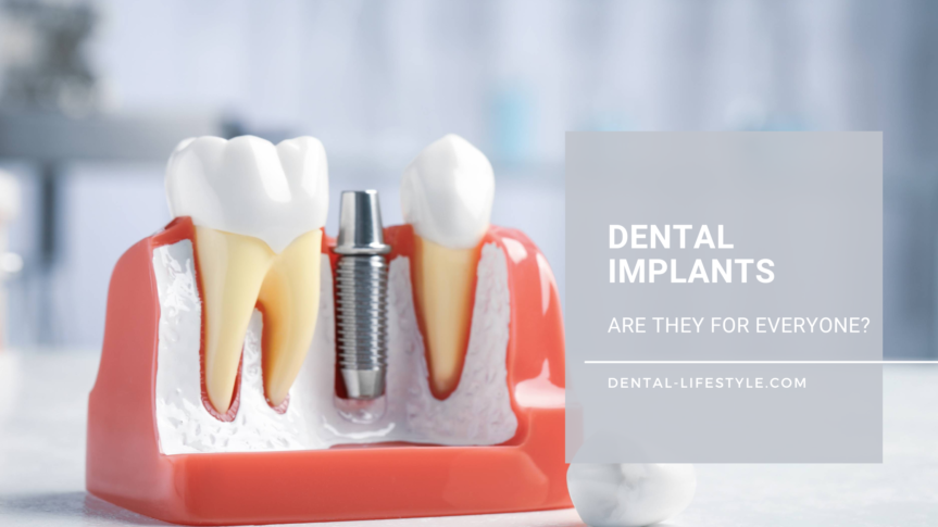 There are a few cases where, unfortunately, implant treatment is not possible.