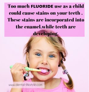 Too much fluoride use as a child could cause stains on your teeth. These stains are incorporated into the enamel , while teeth are developing.