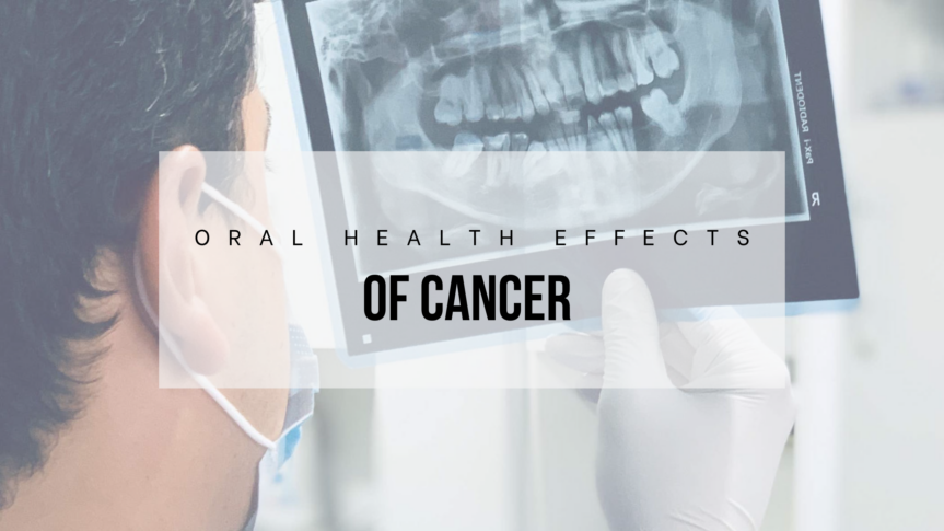 Cancer treatments, such as chemotherapy and radiation, can also affect a patient’s dental health.