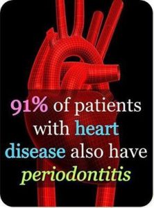 91% of patients with heart diseases also suffer from periodontal diseases. You overall health is connected with your oral heath.