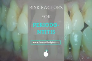 There are specific risk factors that can make it easier for you to get periodontitis. Learn all about how you can prevent this from happenning.