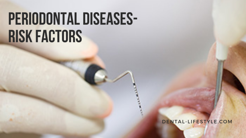 There are specific risk factors that can make it easier for you to get periodontitis.