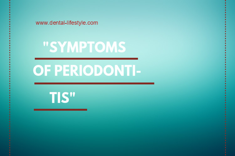 Periodontal disease-symptoms
