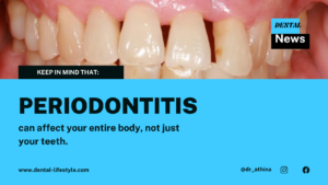 Yes. Periodontal diseases can cause severe problems in our general health.