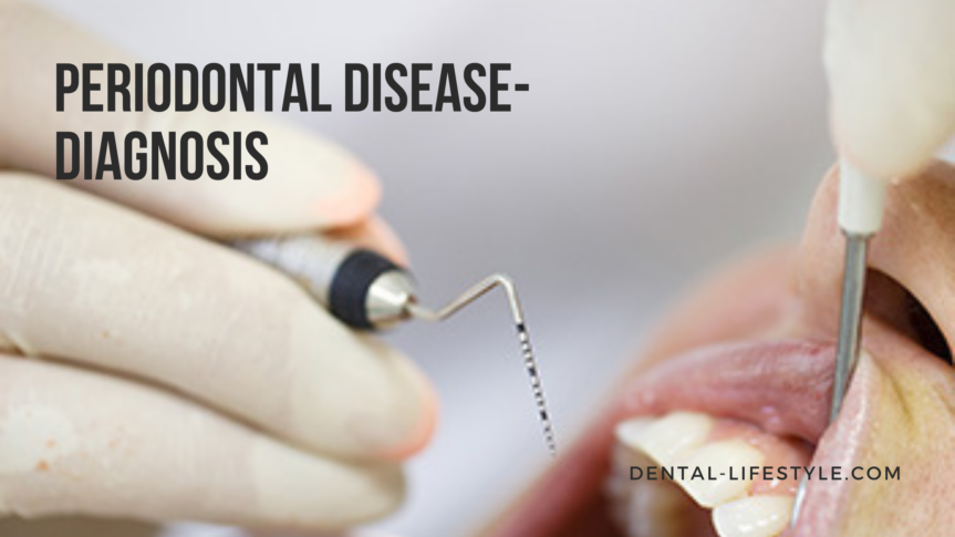 Periodontitis and its diagnosis, keep on reading to learn all about it!