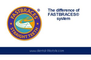 The FASTBRACES ® system was developed in order to move teeth in a different way, making a quick, safe and affordable solution.
