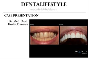 Ο Κώστας Δημάκος απέκτησε τον τίτλο του χειρουργού οδοντιάτρου (DMD, Dentariae Medicinae Doctor) το 1999 και στη συνέχεια μετεκπαιδεύτηκε στην Αισθητική οδοντιατρική στο NYUCD (New York University College of Dentistry , USA). Ο Κ. Δημάκος είναι μέλος του οδοντιατρικού συλλόγου Θεσσαλονίκης, της Ελληνικής Ακαδημίας Αισθητικής Οδοντιατρικής και άλλων επιστημονικών φορέων.