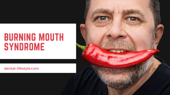 In burning mouth syndrome, the burning sensation can occur in the tongue, lips, palate, or even on the floor of the mouth.
