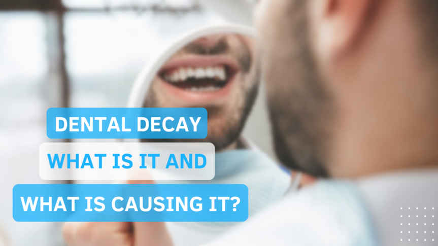 Dental Decay- What is it and What is Causing it?